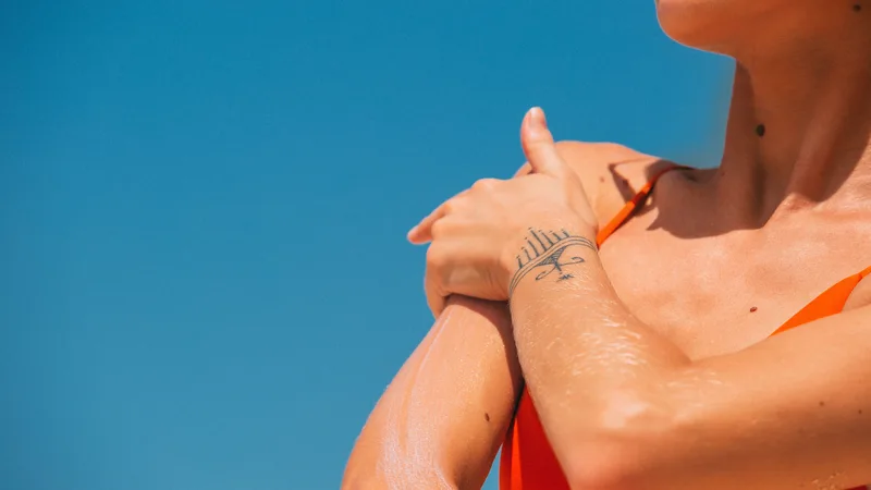 How to Soothe and Treat Sunburn: Essential Skincare Tips