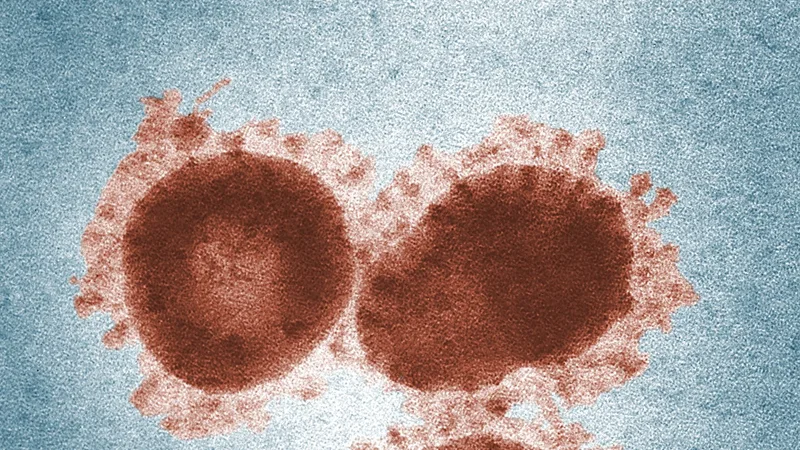 Understanding the Zika Virus: Symptoms, Prevention, and Treatment