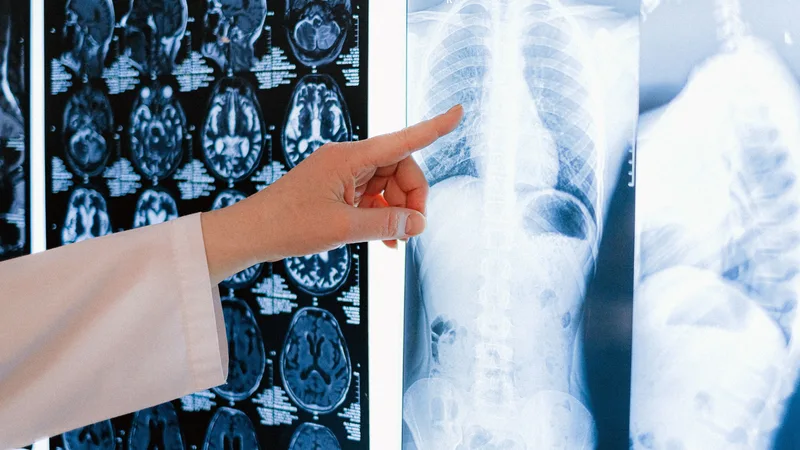 Bone Health Essentials: Foods That Support Strong Bones